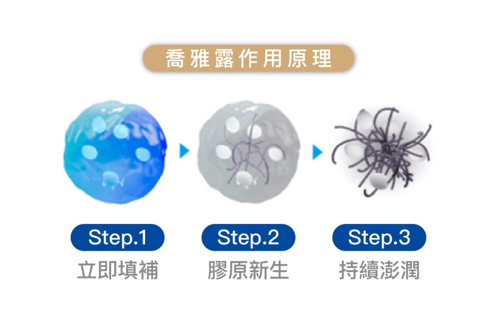 JUVElook喬雅露效果