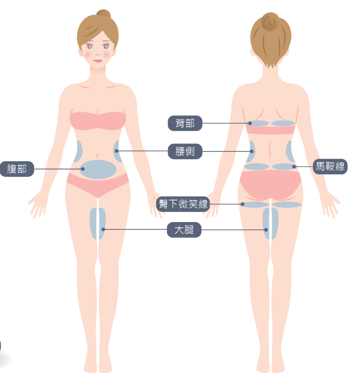 冷凍減脂部位