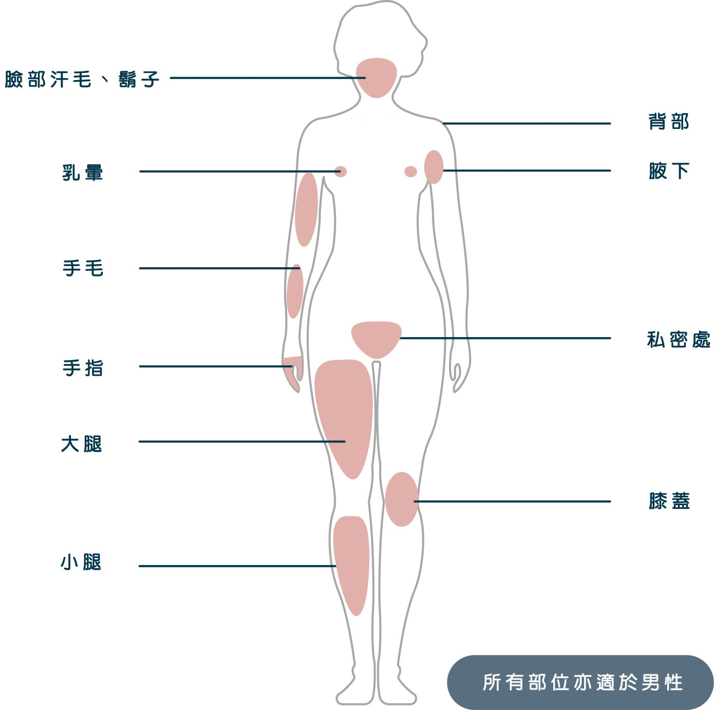 亞歷山大除毛部位