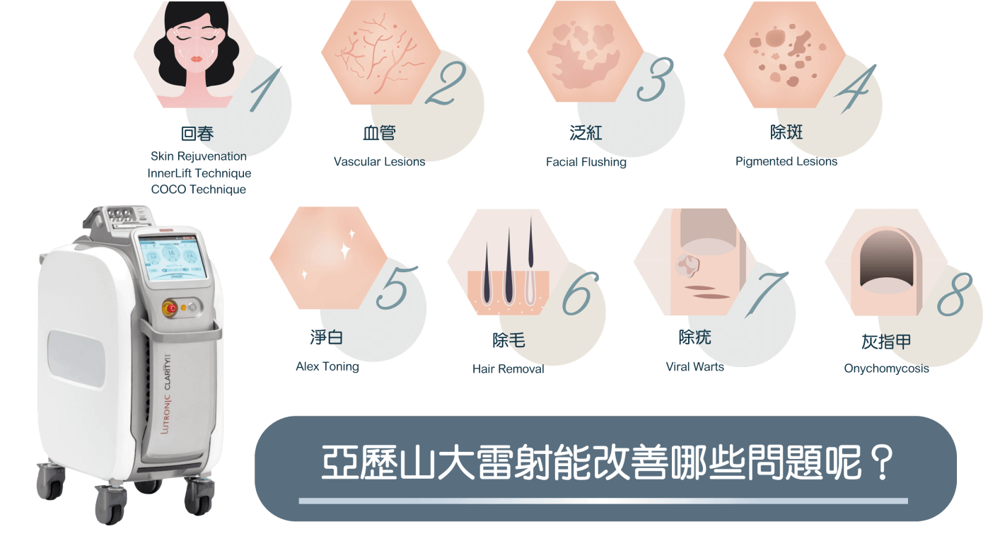 亞歷山大雷射治療項目